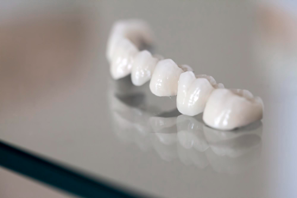 Porcelain Crowns