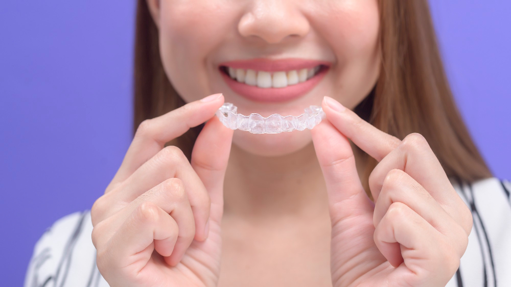 Clear Aligners
