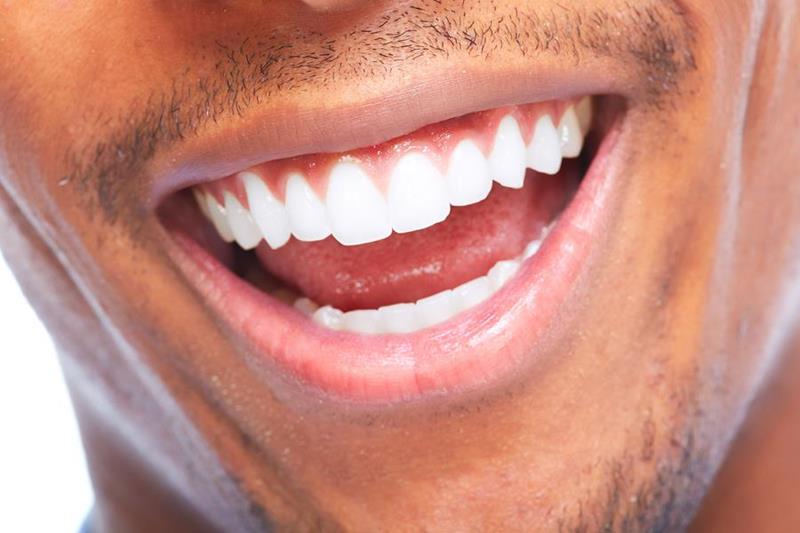 Natural Color Fillings